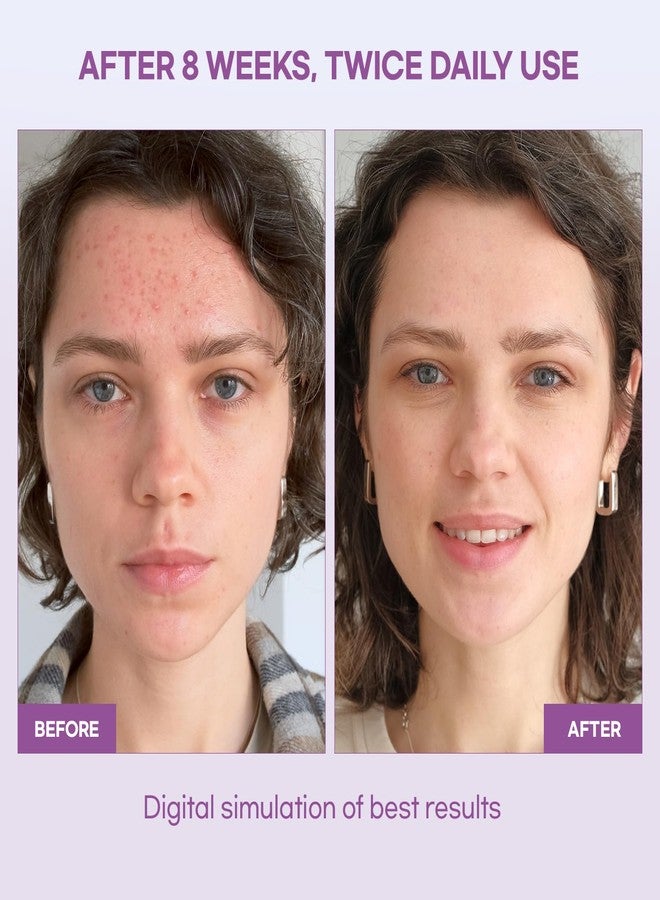 Natural Vine Dark Spot Serum: Dark Spot Remover for Face - Dark Spot Corrector with Grape Extract Fermentation Complex Hyaluronic Acid Vitamin E for Brighter Even Skin Tone 1 FL OZ - Image 3